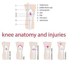 Skeletal system sports injuries tendonitis. Knee Injuries