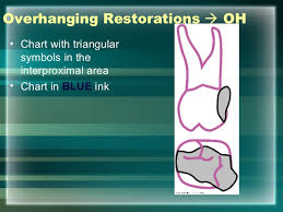 hard tissue charting