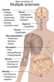 Multiple Sclerosis Subtypes Symptoms Diagnosis And
