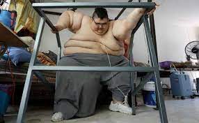 Franco hadde utpekt prins juan carlos til sin etterfølger, og den nye kongen åpnet for demokratiske reformer. Mexican Man Juan Pedro Franco Once The World S Fattest Dreams Of Walking Again