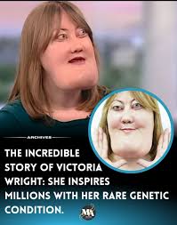 I'm Sofia and I was born with a cleft lip and palate. No one ever explained  that to me growing up. My parents didn't talk about it, not even once. “I  had