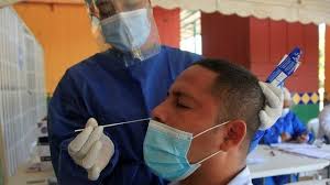 Médico canadiense afirma que nueva cepa de covid puede ser más contagiosa, pero menos mortal. Nueva Cepa De Coronavirus Por Que La Nueva Variante Detectada En Reino Unido Es Tan Contagiosa Bbc News Mundo