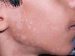 Pin On Best Skin Home Remedies