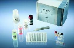 Latent tb infection is diagnosed by detecting specific immunological responses to mycobacterium tuberculosis (mtb) proteins using interferon. Drug Resistant Tuberculosis Test Within Hours Healthcare In Europe Com