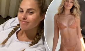 Bikini model Natalie Roser is in hospital as she prepares for scoliosis  surgery | Daily Mail Online