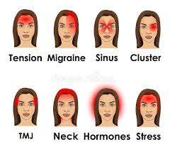 In some cases, an individual suffering from headache may require immediate medical attention. Medical Infographic Template Set Types And Localizations Of Headache Migraine Human Head Silhouette With Pain Stock Vector Illustration Of Diagnosis Isolated 150244126