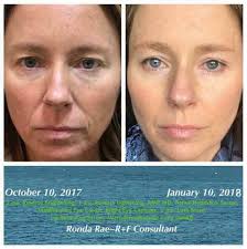 Lorraine Jacobs, Rodan + Fields Independent Consultant (@LJacobsRandF) •  Facebook