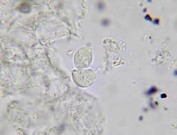 Image result for trichomonas images