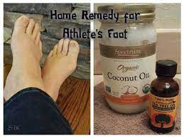 Home Remedy For Athletes Foot Athletes Foot Athletes Foot Cream Athletes Foot Remedies