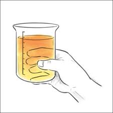 It is important, particularly for those at. Blog Topic Blood In Urine Cxbladder