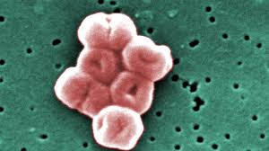 Image result for Striga baumannii