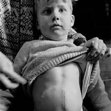 The result of dangerous play, the little boy fell