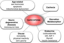 In 2010, the european working group on sarcopenia in older people (ewgsop) published a sarcopenia definition that aimed to foster advances in identifying and caring for people. Consensus Definition Of Sarcopenia Cachexia And Pre Cachexia Joint Document Elaborated By Special Interest Groups Sig Cachexia Anorexia In Chronic Wasting Diseases And Nutrition In Geriatrics Clinical Nutrition