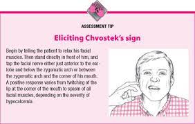 In the late 1800s, dr. Chvostek S Sign May Also Be Present In Hypomagnesemia Frequently Seen In Alcoholics Persons With Diarrh Nurse Teaching Nursing School Notes Nursing Students