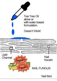 The infected area should first be washed and dried, and using tea tree soap during this cleansing step may help to speed the healing. Top 3 Over The Counter Nail Fungus Products