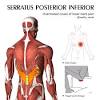 Muscle performance in neck pain assessment and rehab of the deep and superficial neck muscles in the presence of pain powered by physiopedia. 1