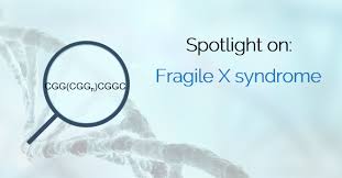 Spotlight On Fragile X Syndrome Variantyx