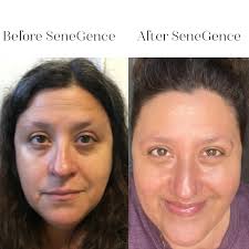 What makes Senegence products different