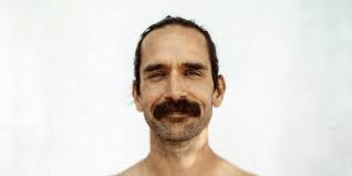 The Plastic Surgery That Freed Me from a Lifetime of Insecurity