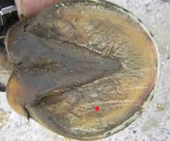 Clou Dans Le Pied Resolu