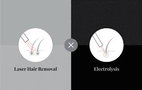 Permanent hair removal for most consumers if performed correctly (which requires considerable training and skill). The Difference Between Electrolysis And Laser Hair Removal Urbana