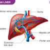 Liver pathophysiology and schematic diagram. 1