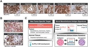Mesothelioma is an aggressive cancer that affects the lungs, heart,. Enhanced Solid Tumor Recognition And T Cell Stemness With Synnotch Car Circuits Biorxiv