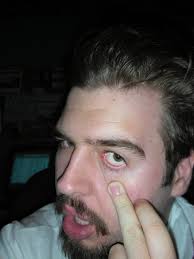 I Don't Wear Contacts