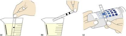 Urinalysis Clinical Gate