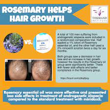 Pin On Hair Thinning