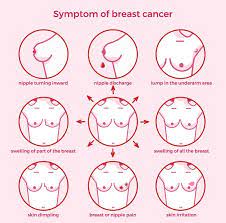 Doctors use many tests to find, or diagnose, breast cancer. Nhs London On Twitter October Is Breastcancerawarenessmonth So What Better Time To Get Familiar With The Signs And Symptoms Of Breast Cancer Make Sure You Check Your Breast Regularly For Changes Like