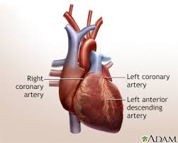 Heart Bypass Surgery Minimally Invasive Information Mount Sinai New York