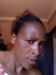 How can u remove the black stuff off ???