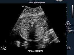 Fetal Ultrasound Image Gallery Fetal Pictures Of Ultrasound