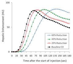 Заражено3 793 810+ 19 138вылечилось3 229 258умерло71 651 заражено922 559+ 2 897вылечилось797 462умерло13 237. Intravenous Contrast Medium Administration And Scan Timing At Ct Considerations And Approaches Radiology