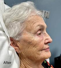 Dr. Linda Fromm at Rapid City Medical Center