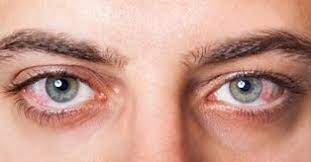 Les yeux sont reliés à la vision que l'on a de notre vie intérieure et de notre vie extérieure : Vous Avez Les Yeux Rouges Ou La Paupiere Qui Tremble