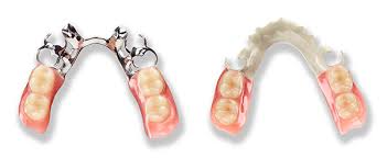 1.2 diy dentures at home. The Past Present And Future Of Removable Dentures Dentistry Today