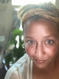 Why do I lose hair when braiding?