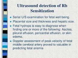 Image result for Rh Sensitization