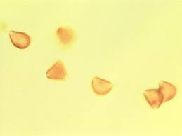 Image result for Faurea rochetiana