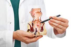 What You Should Know About Anodyspareunia