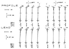 Accuracy Of Gears Khk Gears