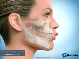 We did not find results for: Kieferorthopadie Videos Profilkorrektur