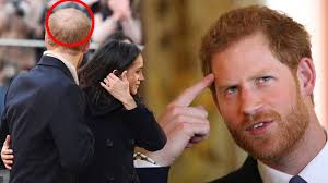 Prince Harry's hair loss is SPREADING ...