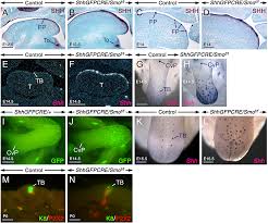 Also, the taste buds you still have may shrink and become less sensitive. Plos Genetics Cell Fate Specification In The Lingual Epithelium Is Controlled By Antagonistic Activities Of Sonic Hedgehog And Retinoic Acid