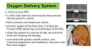Oxygen cannulas or nasal cannulas are used to supply supplementary oxygen to the patient. Prepared By Dr Irene Roco Ppt Video Online Download