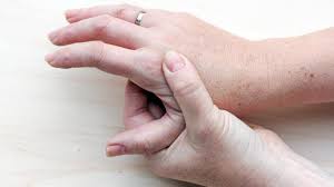 Lupus hand sign #lhandsign campaign. 12 Symptoms Of Lupus