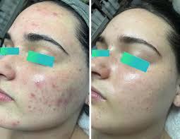 Abbie Major Skin Love