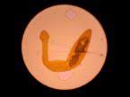 فحص الإصابة بالديدان الشريطية cestodes or tape worms مدونة التفوق worms